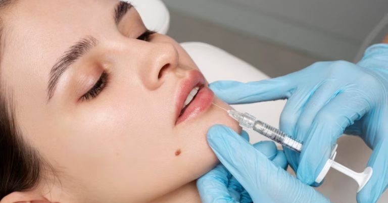 Lip Lift Surgery: Which Procedures Might Be Right For You?